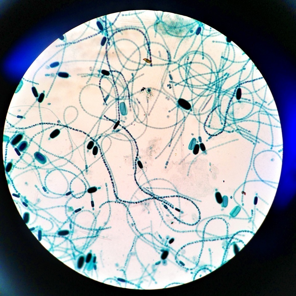 imgs_piq8q_ref.clyndrospermum_cyanobacteria.jpg